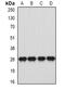 Major Histocompatibility Complex, Class II, DQ Alpha 1 antibody, abx225215, Abbexa, Western Blot image 