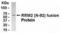 Ribonucleotide Reductase Regulatory Subunit M2 antibody, XW-7968, ProSci, Western Blot image 