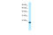 Tumor necrosis factor receptor superfamily member 18 antibody, 31-021, ProSci, Western Blot image 