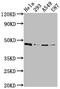 Mitogen-Activated Protein Kinase Kinase 1 antibody, CSB-RA225579A0HU, Cusabio, Western Blot image 