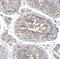 ATP Binding Cassette Subfamily C Member 11 antibody, NBP1-82623, Novus Biologicals, Immunohistochemistry paraffin image 