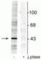 EPH Receptor B2 antibody, P01507, Boster Biological Technology, Western Blot image 