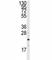 Ras antibody, F50733-0.4ML, NSJ Bioreagents, Western Blot image 