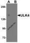 Unc-51 Like Kinase 4 antibody, 7587, ProSci Inc, Western Blot image 