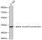 Actin Alpha 2, Smooth Muscle antibody, 13-335, ProSci, Western Blot image 