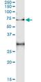 Tripeptidyl Peptidase 1 antibody, MA5-24560, Invitrogen Antibodies, Immunoprecipitation image 