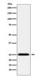 B Cell Receptor Associated Protein 31 antibody, M03767-1, Boster Biological Technology, Western Blot image 