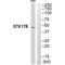 Serine/Threonine Kinase 17b antibody, A08711-1, Boster Biological Technology, Western Blot image 