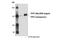 Tripeptidyl Peptidase 2 antibody, 14981S, Cell Signaling Technology, Western Blot image 