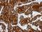 Keratin 17 antibody, GTX114112, GeneTex, Immunohistochemistry paraffin image 