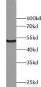 Zinc Finger Protein 622 antibody, FNab09721, FineTest, Western Blot image 