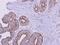 Acyl-CoA Dehydrogenase Medium Chain antibody, PA5-27201, Invitrogen Antibodies, Immunohistochemistry frozen image 