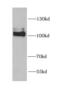 Neuroligin 4 Y-Linked antibody, FNab05755, FineTest, Western Blot image 