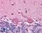 Perilipin 3 antibody, LS-C141361, Lifespan Biosciences, Immunohistochemistry paraffin image 