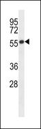 Gamma-Aminobutyric Acid Type A Receptor Beta2 Subunit antibody, LS-C166327, Lifespan Biosciences, Western Blot image 