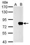 SLU7 Homolog, Splicing Factor antibody, NBP2-20403, Novus Biologicals, Western Blot image 