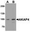AKAP4 antibody, A07362, Boster Biological Technology, Western Blot image 