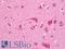 Ectodysplasin A antibody, LS-B12140, Lifespan Biosciences, Immunohistochemistry frozen image 