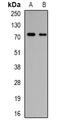 Polypeptide N-Acetylgalactosaminyltransferase 3 antibody, abx141356, Abbexa, Western Blot image 