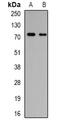 Polypeptide N-acetylgalactosaminyltransferase 3 antibody, abx141356, Abbexa, Western Blot image 