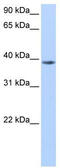 Nudix Hydrolase 13 antibody, TA346779, Origene, Western Blot image 