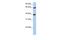 Transketolase antibody, PA5-43192, Invitrogen Antibodies, Western Blot image 