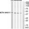 Thymidine Kinase 1 antibody, TA311812, Origene, Western Blot image 