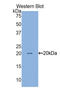 Baculoviral IAP Repeat Containing 5 antibody, LS-C302240, Lifespan Biosciences, Western Blot image 