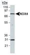 NADPH Oxidase 4 antibody, NB110-58851H, Novus Biologicals, Western Blot image 