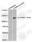 Protein Kinase D1 antibody, AP0159, ABclonal Technology, Western Blot image 