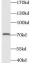 IL2 Inducible T Cell Kinase antibody, FNab04414, FineTest, Western Blot image 