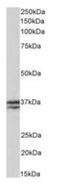 Troponin T1, Slow Skeletal Type antibody, orb79336, Biorbyt, Western Blot image 