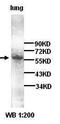 4F2 light chain antibody, orb77270, Biorbyt, Western Blot image 