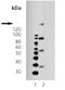 Platelet Derived Growth Factor Receptor Beta antibody, M00096, Boster Biological Technology, Western Blot image 