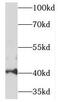 Testin LIM Domain Protein antibody, FNab08600, FineTest, Western Blot image 