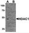 Histone Deacetylase 1 antibody, TA349072, Origene, Western Blot image 