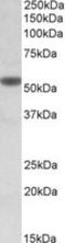 Cholinergic Receptor Nicotinic Alpha 5 Subunit antibody, LS-B8364, Lifespan Biosciences, Western Blot image 