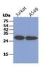 Tubulin Folding Cofactor B antibody, GTX53790, GeneTex, Western Blot image 