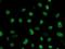 Fragile X Mental Retardation 1 antibody, NBP2-45689, Novus Biologicals, Immunofluorescence image 