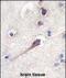 Hippocalcin antibody, A03907, Boster Biological Technology, Immunohistochemistry paraffin image 