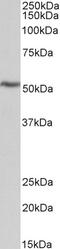 Capping Actin Protein, Gelsolin Like antibody, 43-521, ProSci, Immunofluorescence image 