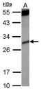 Killer Cell Immunoglobulin Like Receptor, Two Ig Domains And Short Cytoplasmic Tail 4 antibody, PA5-29577, Invitrogen Antibodies, Western Blot image 