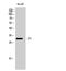 Mitochondrial Translational Initiation Factor 3 antibody, A11221, Boster Biological Technology, Western Blot image 