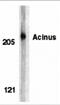 Apoptotic Chromatin Condensation Inducer 1 antibody, 2241, ProSci, Western Blot image 