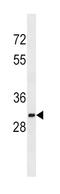 Sulfotransferase Family 1A Member 2 antibody, abx028704, Abbexa, Western Blot image 