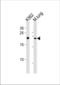 Core-Binding Factor Subunit Beta antibody, TA324878, Origene, Western Blot image 