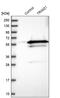 SS-A antibody, PA5-52178, Invitrogen Antibodies, Western Blot image 