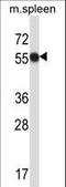 Megakaryocyte-Associated Tyrosine Kinase antibody, LS-C164482, Lifespan Biosciences, Western Blot image 