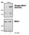 BRCA1 DNA Repair Associated antibody, PA5-17503, Invitrogen Antibodies, Western Blot image 