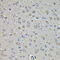 EPH Receptor A3 antibody, 23-567, ProSci, Immunohistochemistry frozen image 